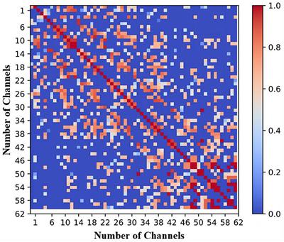 Two-stage sparse multi-objective evolutionary algorithm for channel selection optimization in BCIs